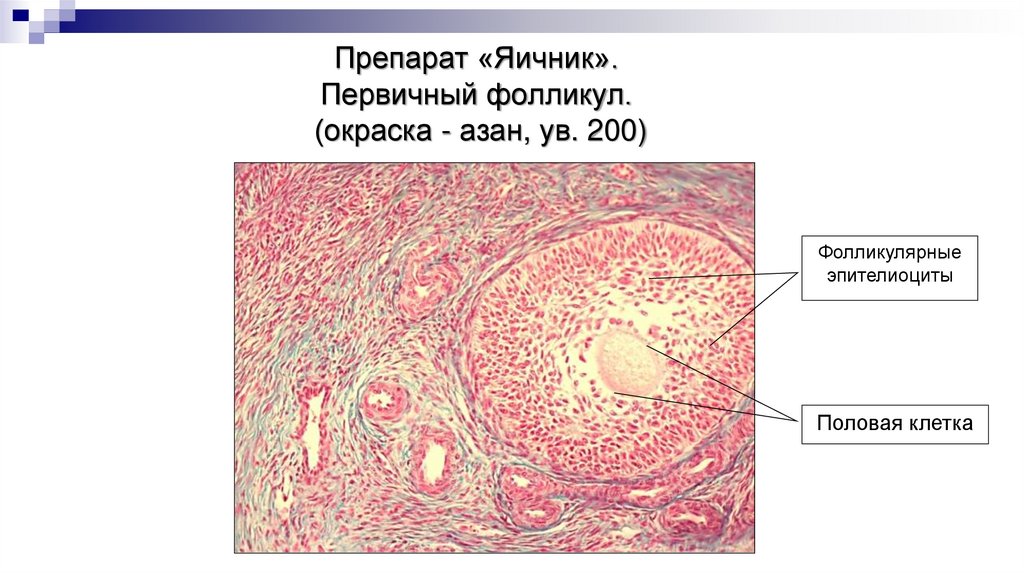 Препарат «Яичник». Первичный фолликул. (окраска - азан, ув. 200)