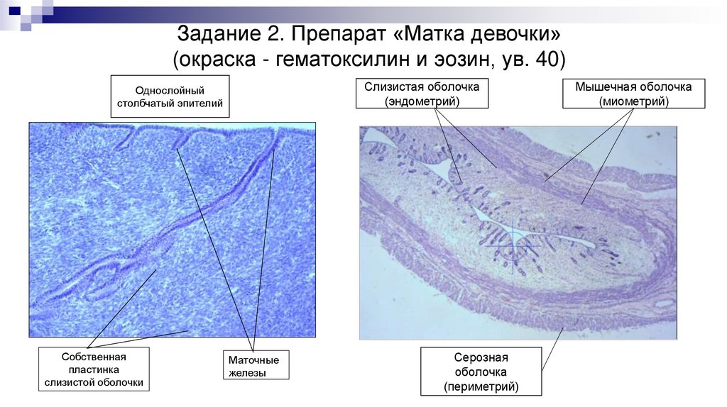 Задание 2. Препарат «Матка девочки» (окраска - гематоксилин и эозин, ув. 40)