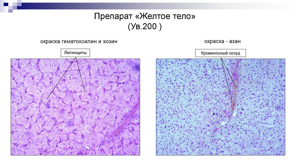 Препарат «Желтое тело» (Ув.200 )