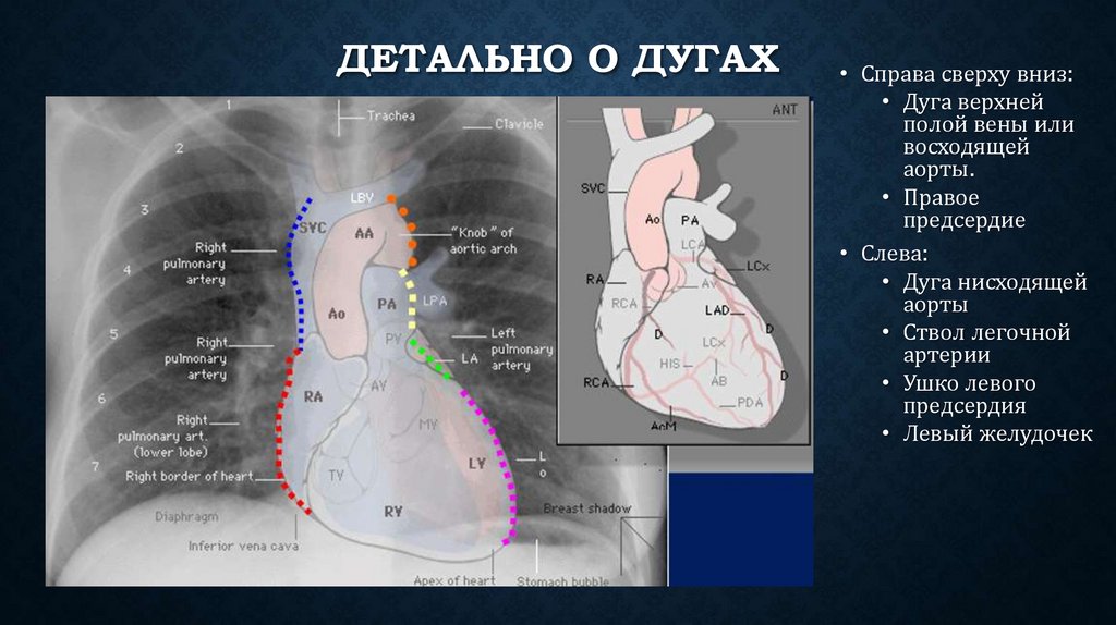 Детально о дугах