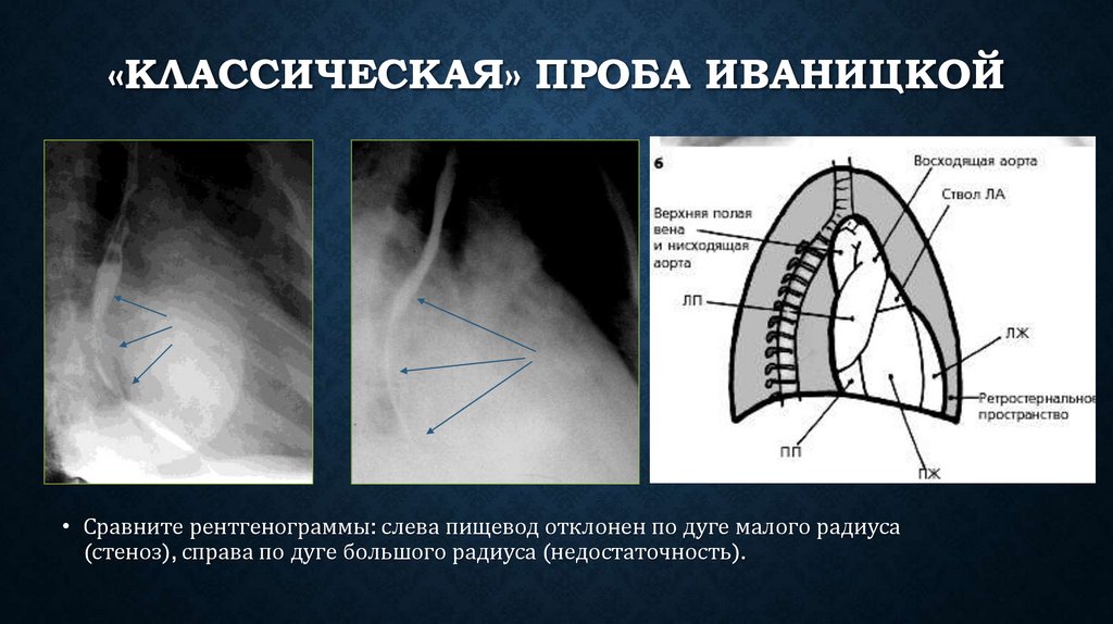 «Классическая» проба Иваницкой