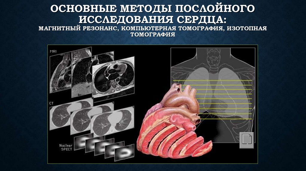 Основные методы послойного исследования сердца: магнитный резонанс, компьютерная томография, изотопная томография