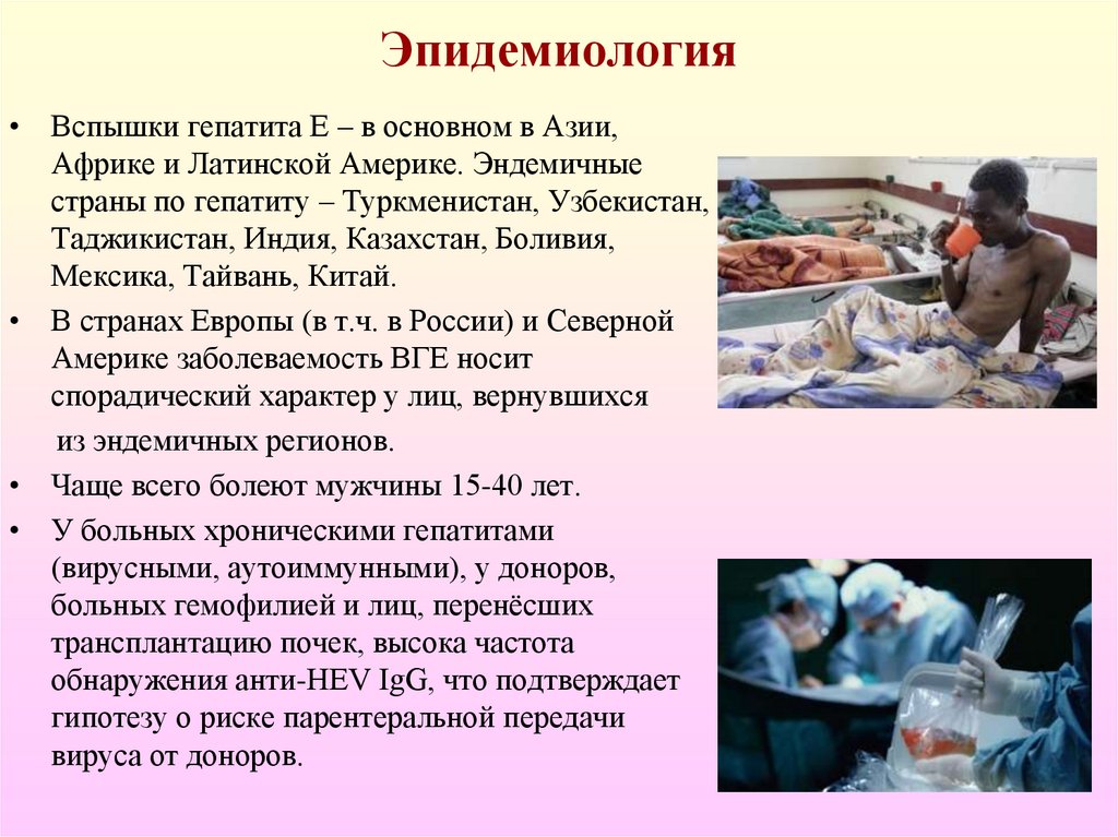 Эпидемиология