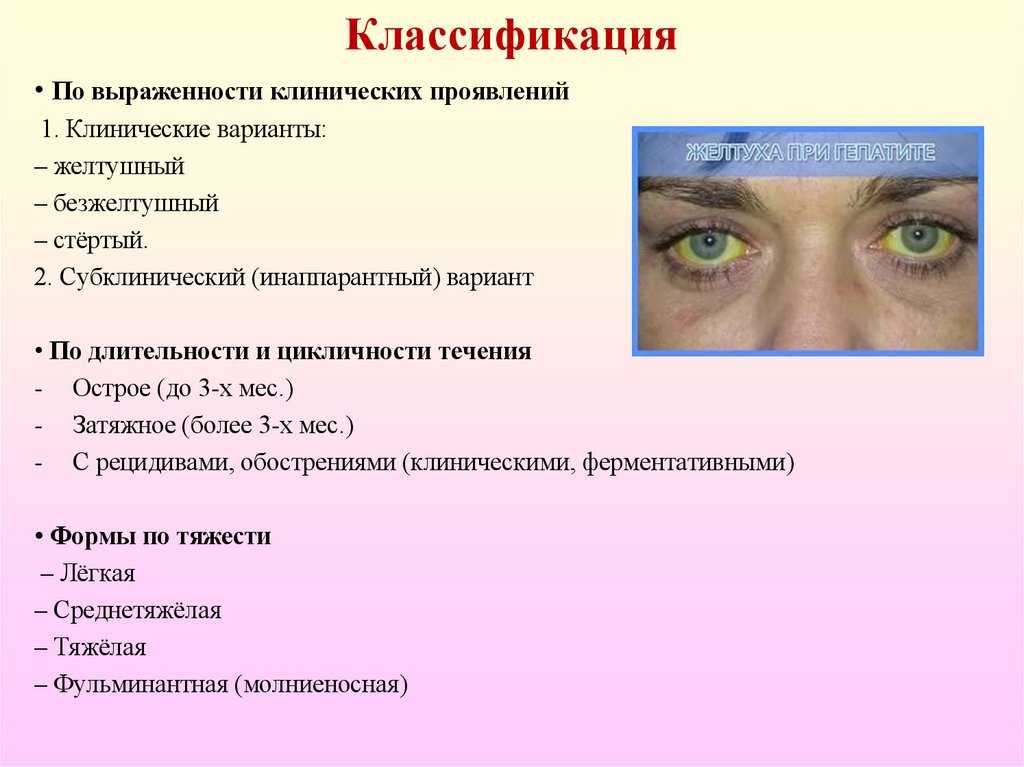 Классификация