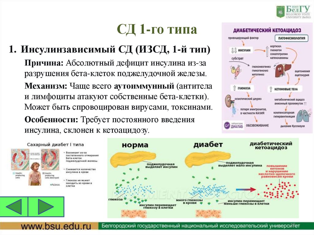СД 1-го типа