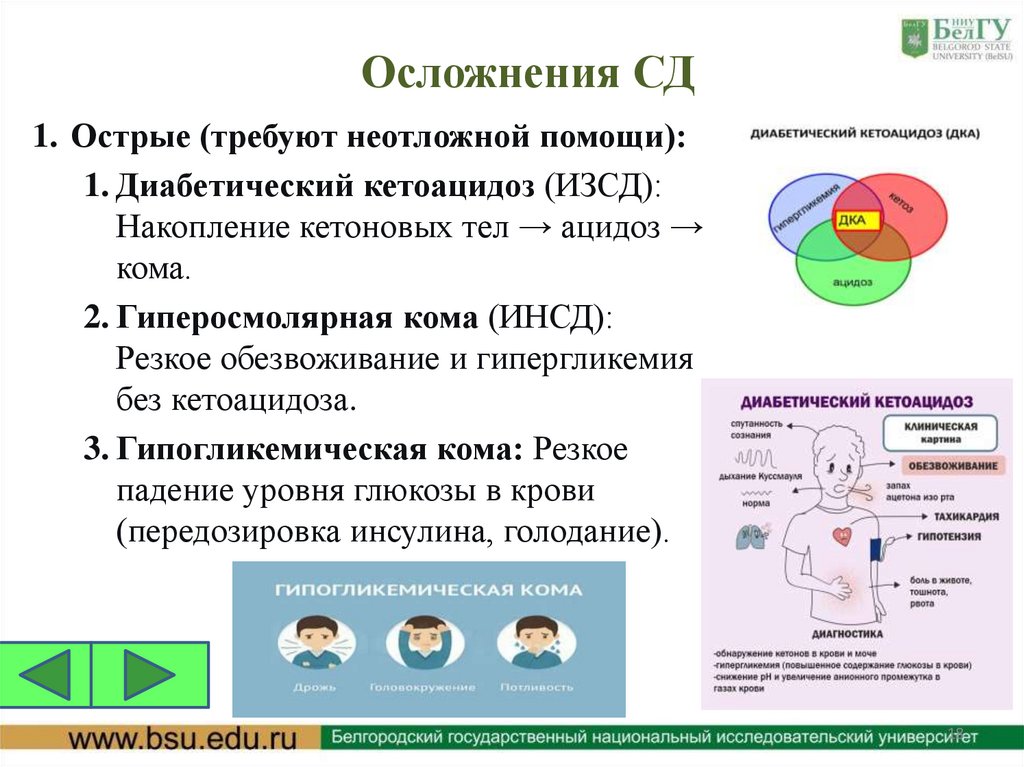 Осложнения СД