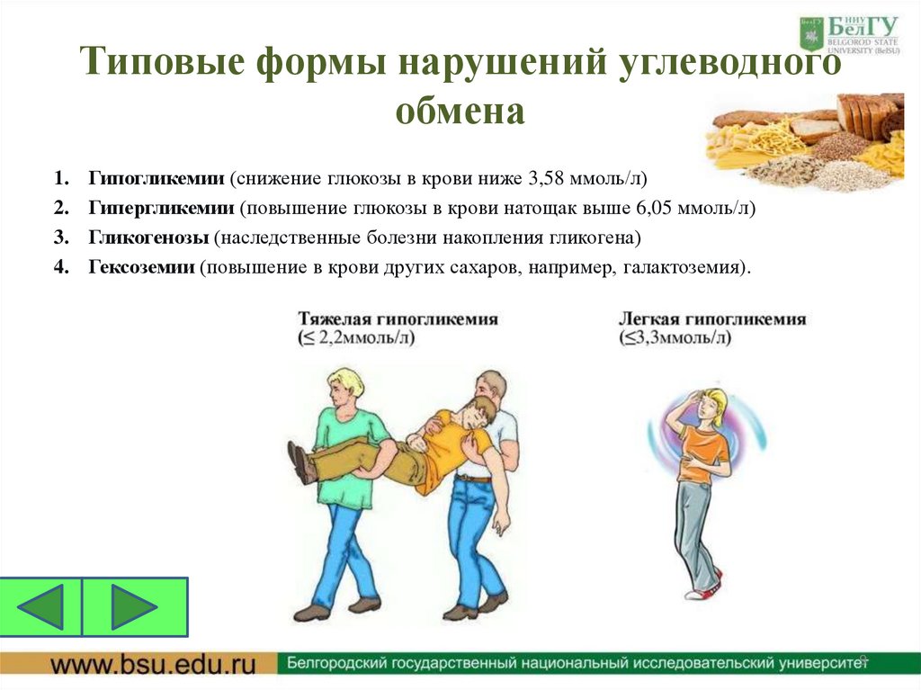 Типовые формы нарушений углеводного обмена