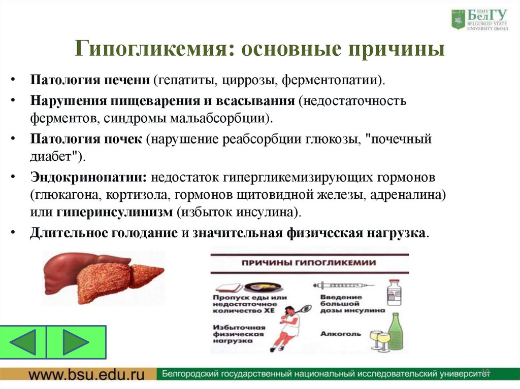 Гипогликемия: основные причины