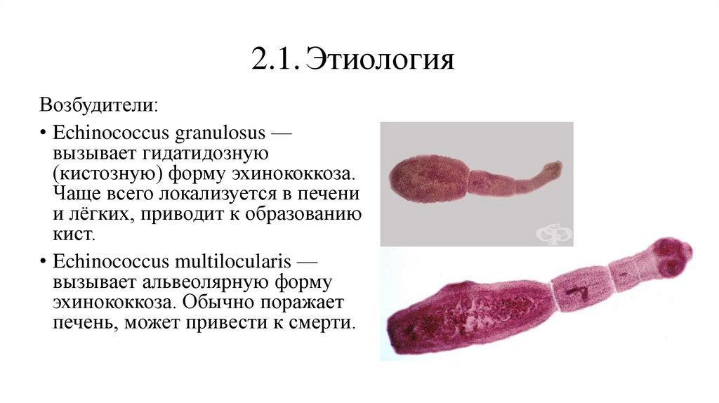 2.1. Этиология