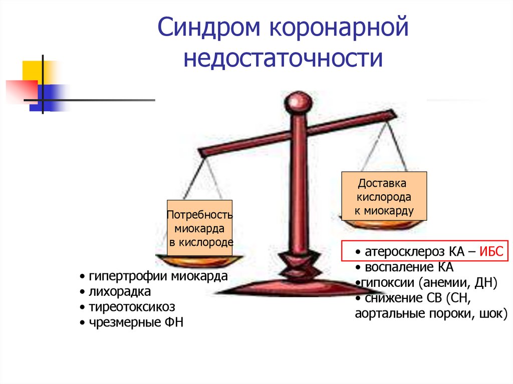 Синдром коронарной недостаточности