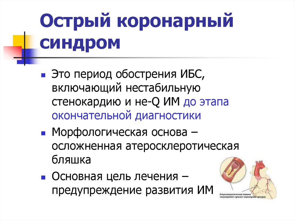 Острый коронарный синдром