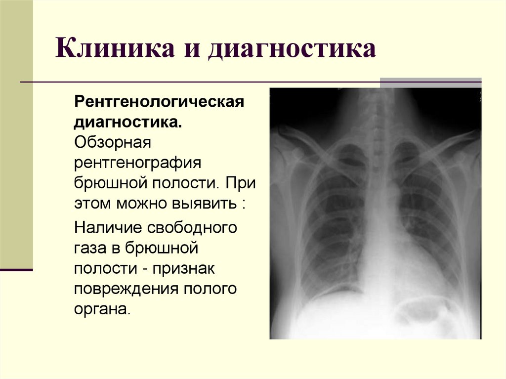 Клиника и диагностика