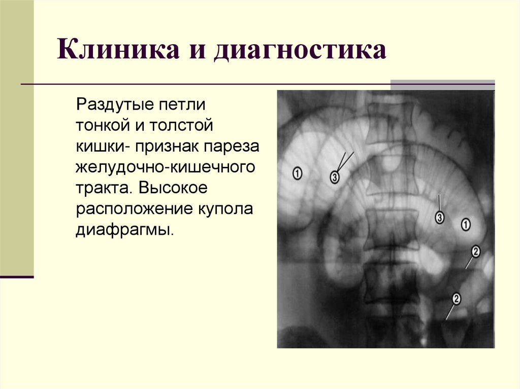 Клиника и диагностика