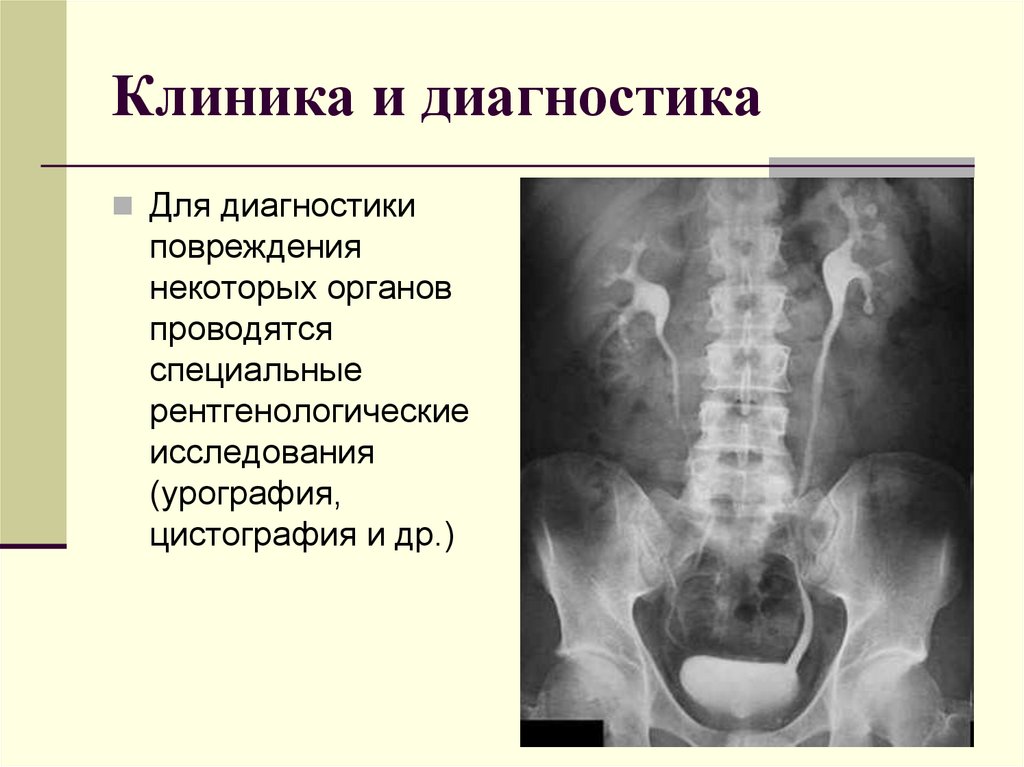 Клиника и диагностика