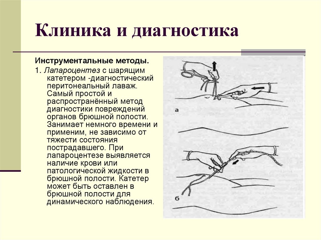 Клиника и диагностика