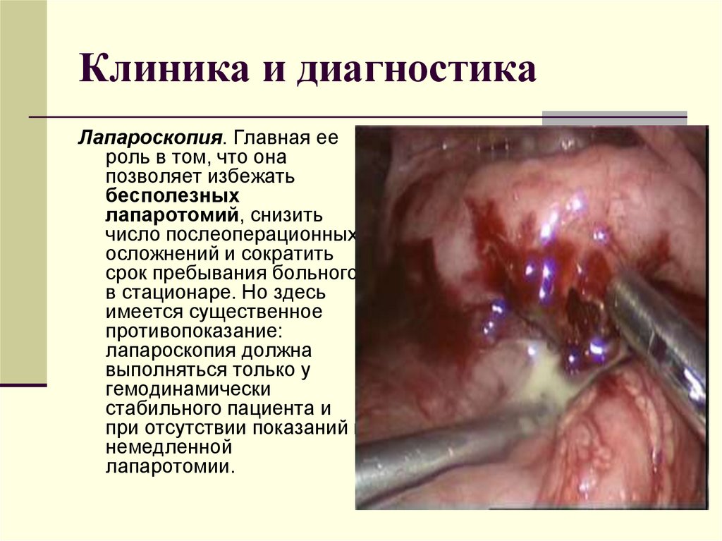Клиника и диагностика