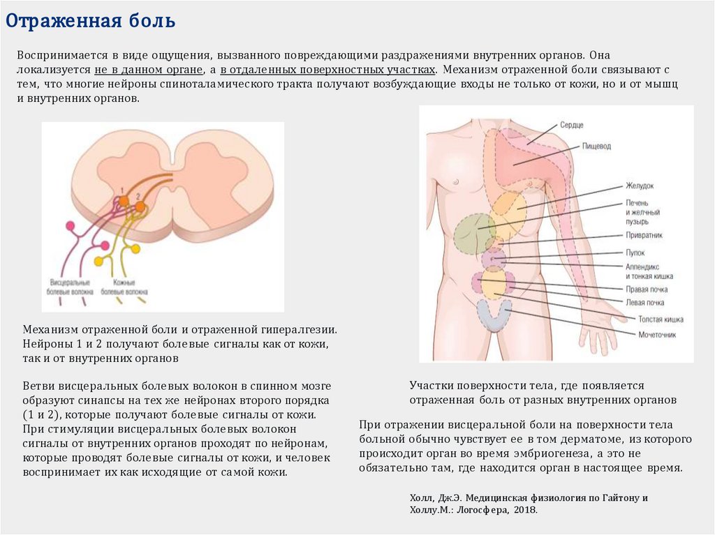Отраженная боль