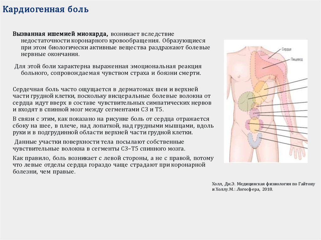 Кардиогенная боль