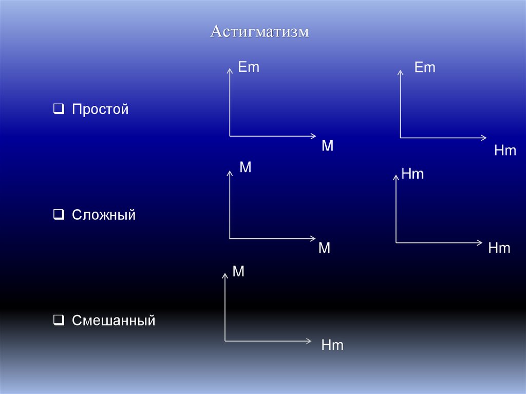 Астигматизм
