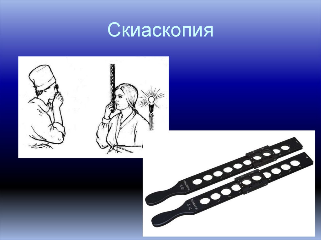 Скиаскопия