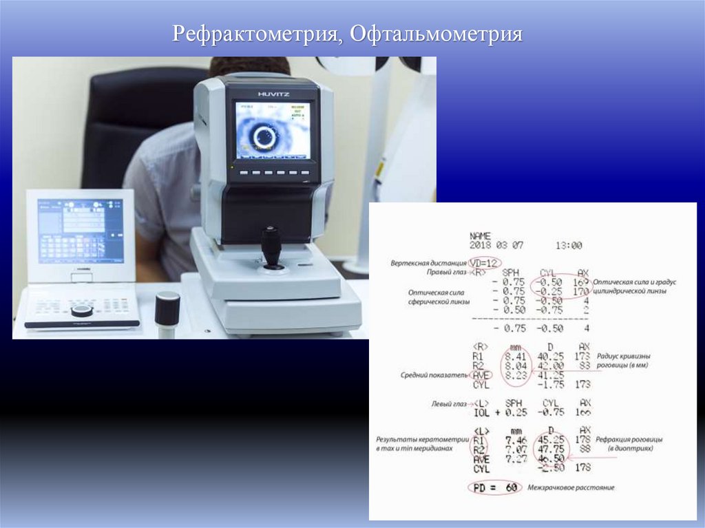 Рефрактометрия, Офтальмометрия