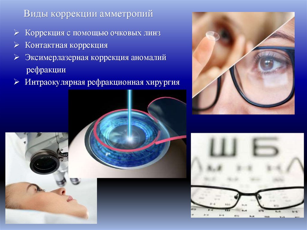 Виды коррекции амметропий
