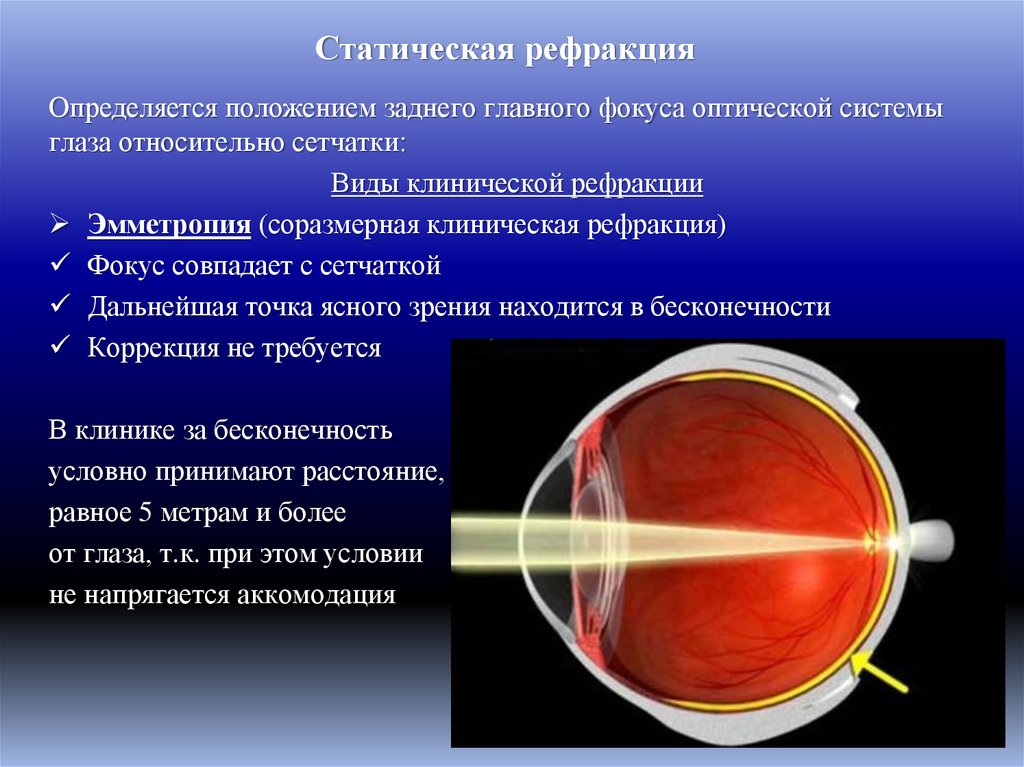 Статическая рефракция