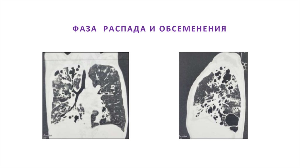 ФАЗА РАСПАДА И ОБСЕМЕНЕНИЯ