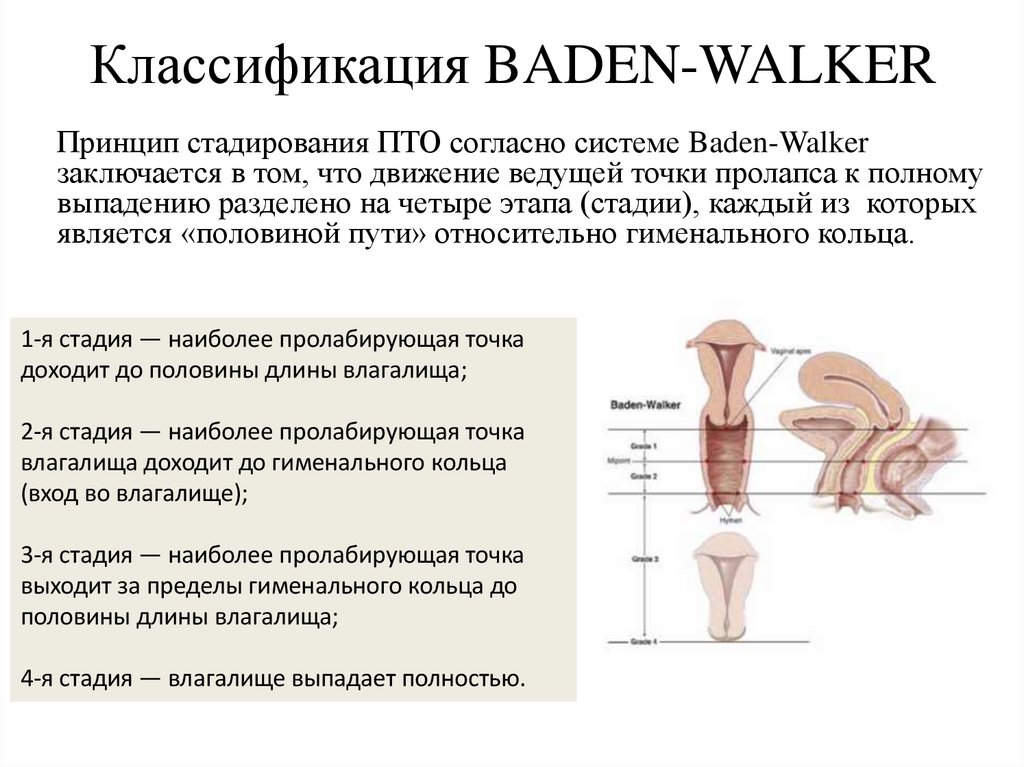 Классификация BADEN-WALKER