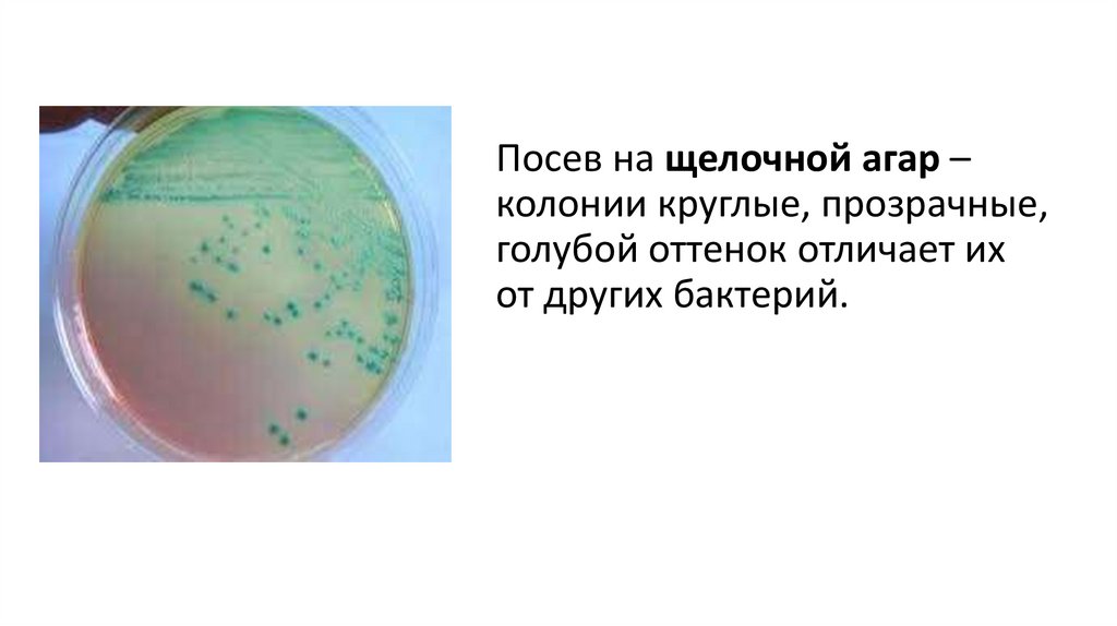 Посев на щелочной агар – колонии круглые, прозрачные, голубой оттенок отличает их от других бактерий.