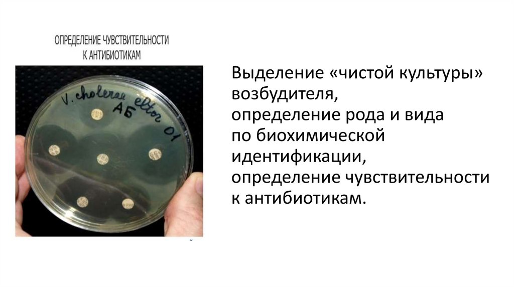 Выделение «чистой культуры» возбудителя, определение рода и вида по биохимической идентификации, определение чувствительности к