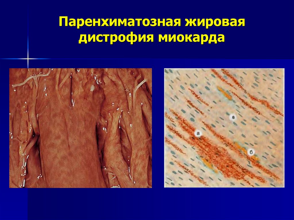 Внешний вид сердца: