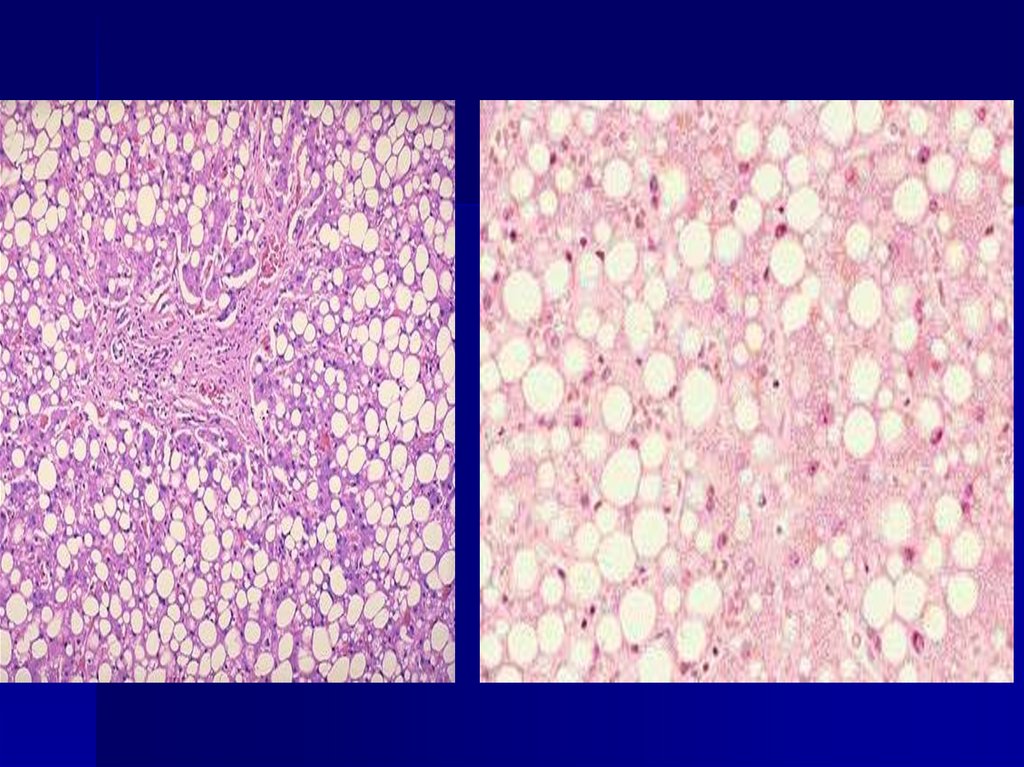 Методы выявления жировых включений
