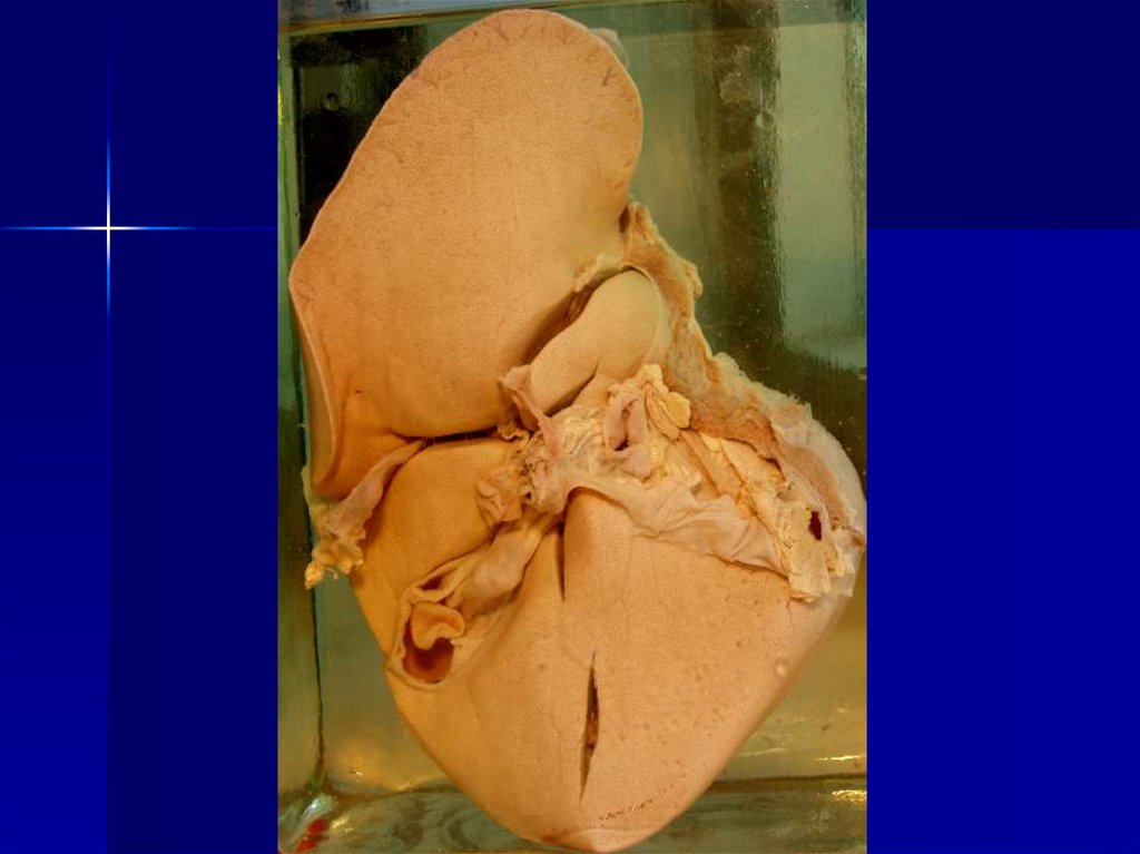 Внешний вид печени: