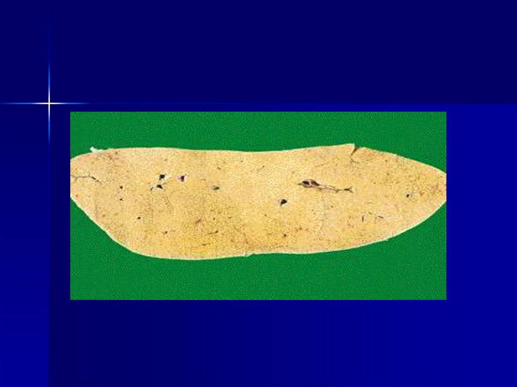 Паренхиматозная жировая дистрофия печени