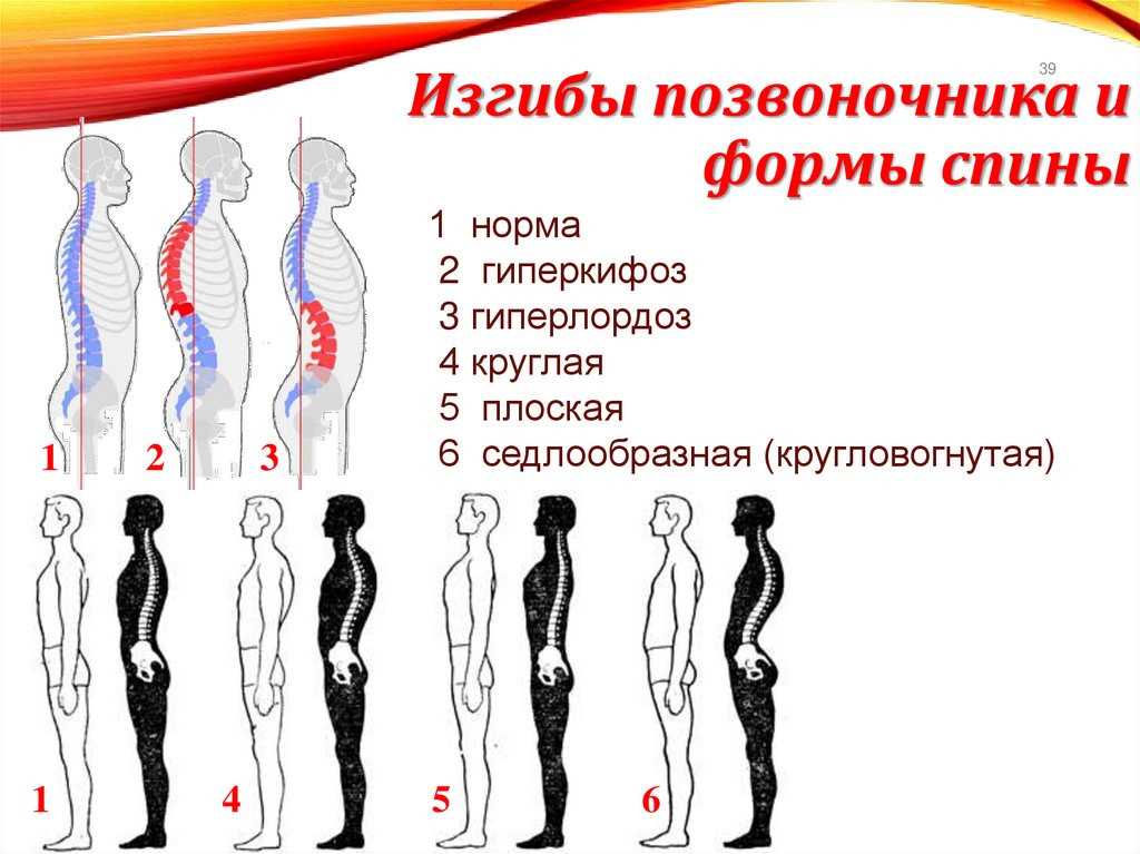 Изгибы позвоночника и формы спины