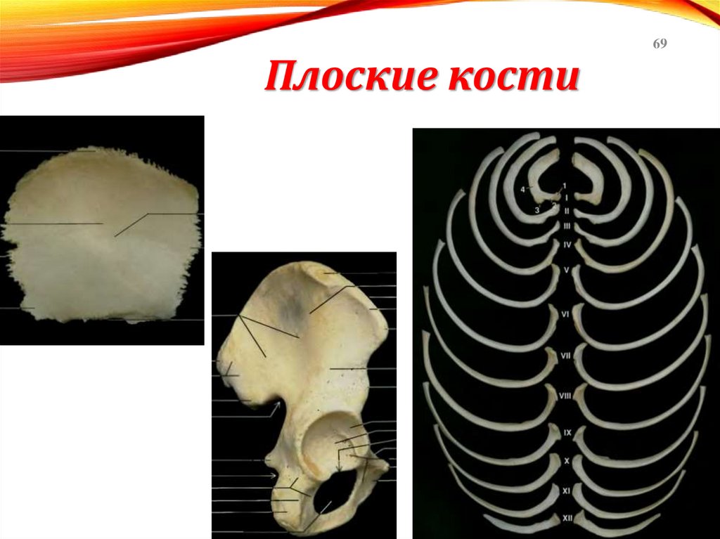 Плоские кости