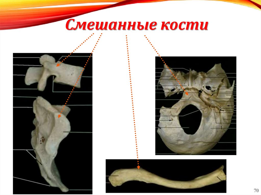 Смешанные кости