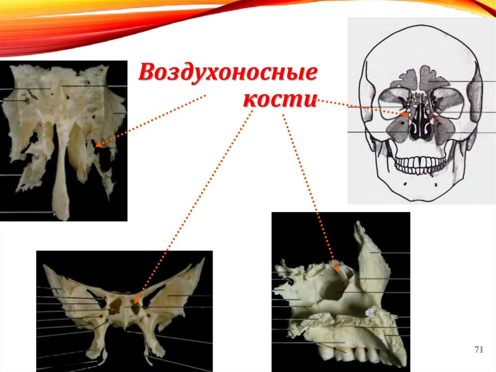 Воздухоносные кости