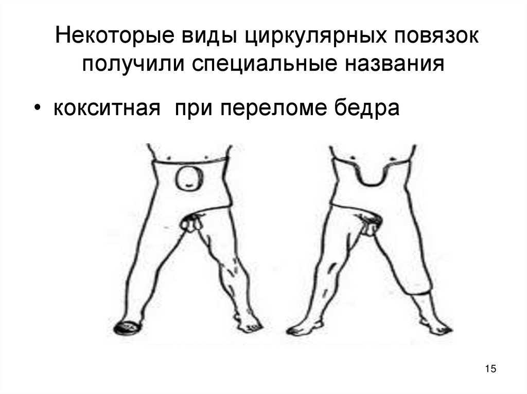 Некоторые виды циркулярных повязок получили специальные названия