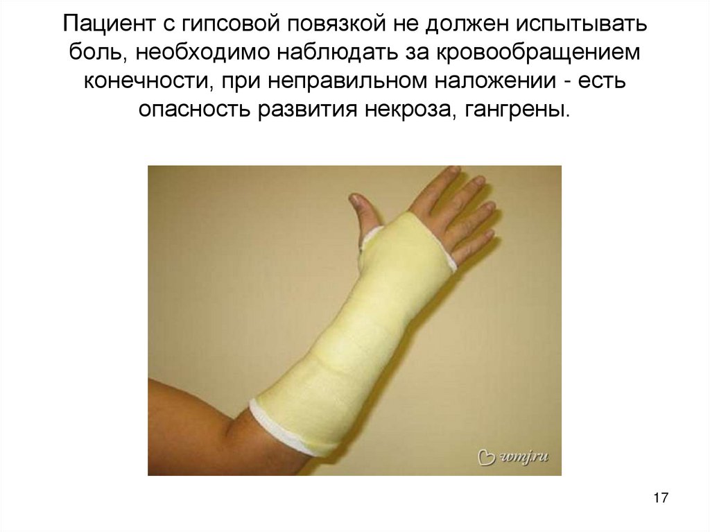 Пациент с гипсовой повязкой не должен испытывать боль, необходимо наблюдать за кровообращением конечности, при неправильном