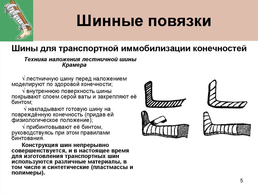 Шинные повязки