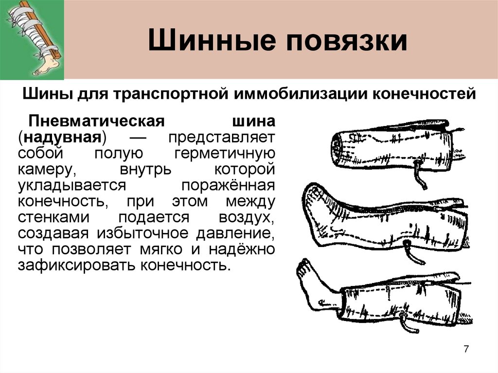 Шинные повязки