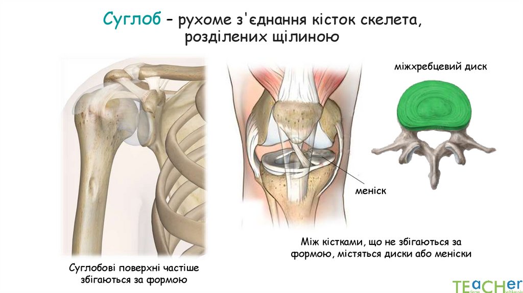 Суглоб – рухоме з'єднання кісток скелета, розділених щілиною