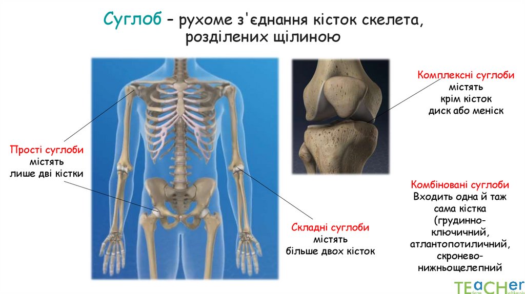 Суглоб – рухоме з'єднання кісток скелета, розділених щілиною