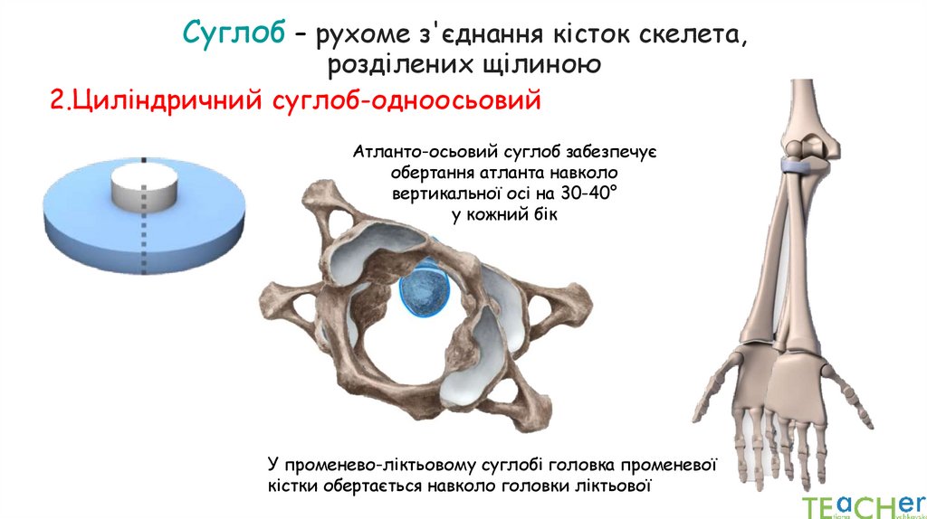 Суглоб – рухоме з'єднання кісток скелета, розділених щілиною