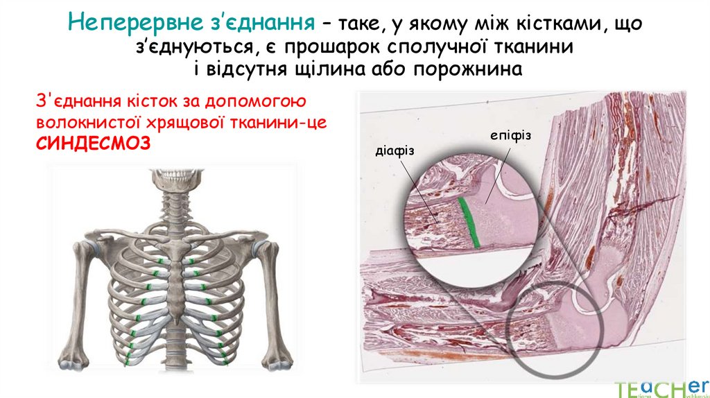 Неперервне з’єднання – таке, у якому між кістками, що з’єднуються, є прошарок сполучної тканини і відсутня щілина або порожнина