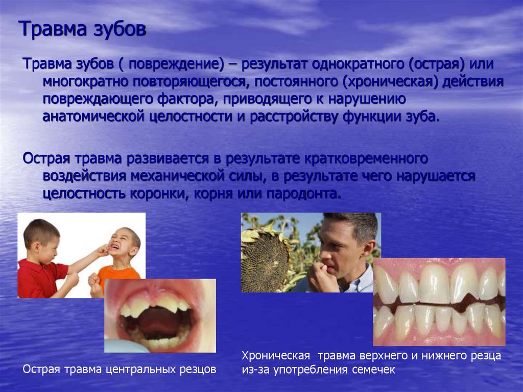 Травма зубов