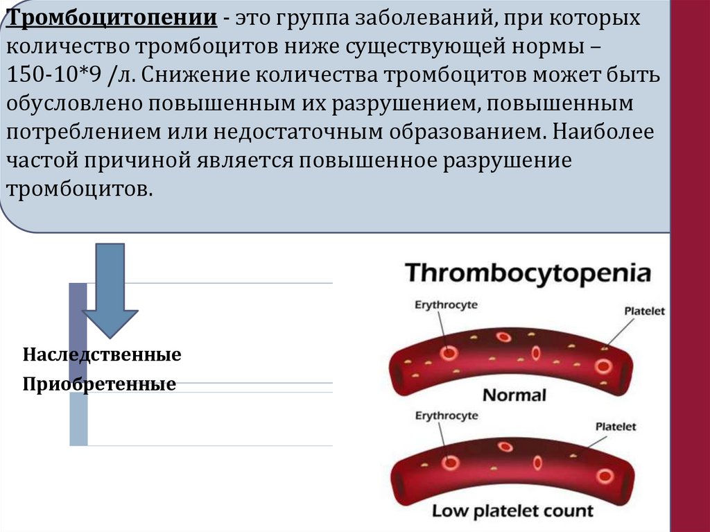Тромбоцитопении - это группа заболеваний, при которых количество тромбоцитов ниже существующей нормы – 150-10*9 /л. Снижение