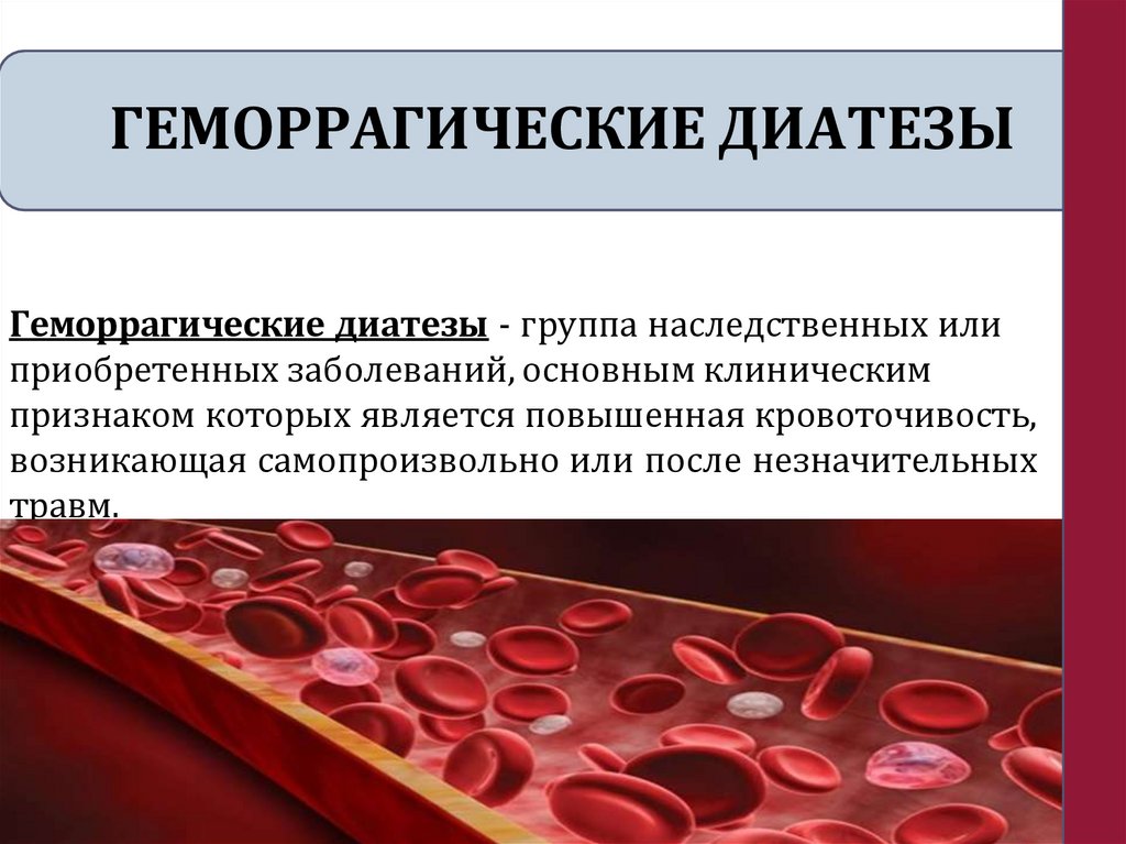 ГЕМОРРАГИЧЕСКИЕ ДИАТЕЗЫ